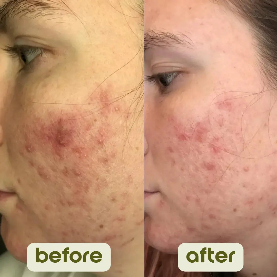 Skincare and Season Changes: What You Need to Know - Donata Skinfood