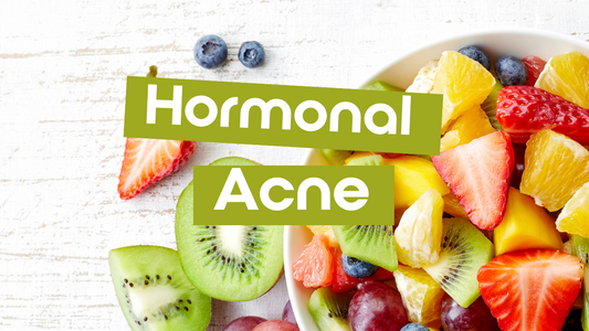 8 Ways to Reduce Hormonal Acne