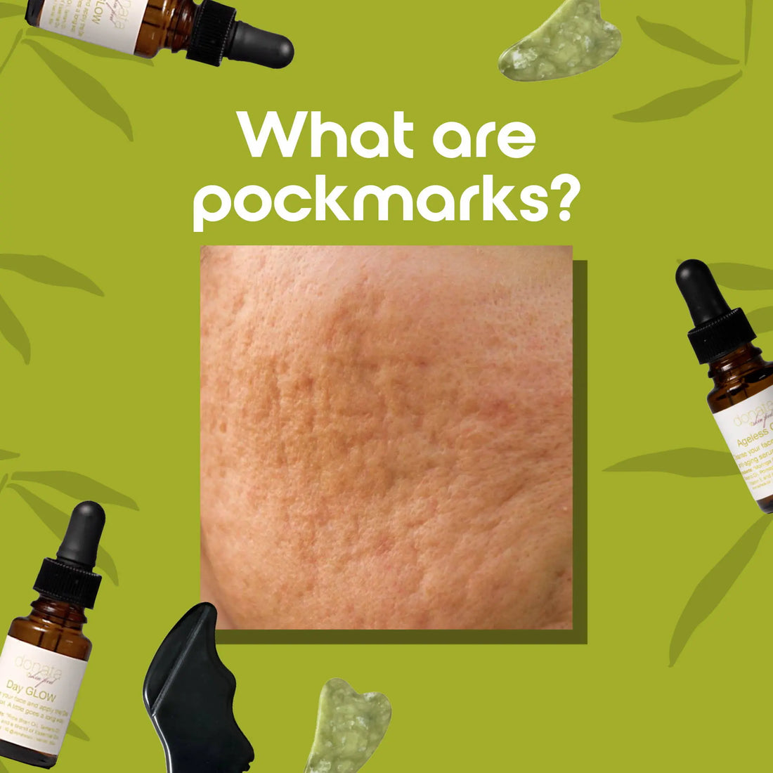 What are Pockmarks? - Donata Skinfood